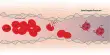 Red Blood Cells exposed to Low oxygen levels protect against Myocardial Infarction