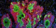 Researchers Devise a Novel method for identifying Tumors from Normal Tissue