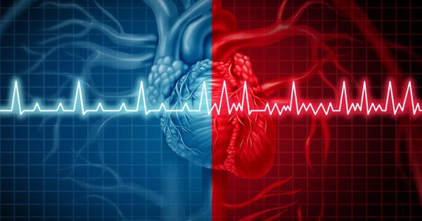 Stress and Insomnia are connected to Abnormal Heart Rhythms after Menopause