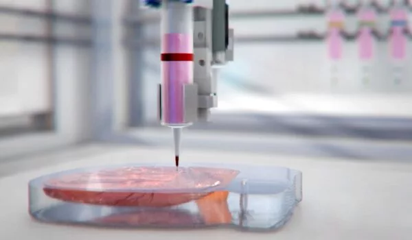 Cell-friendly bioprinting at high fidelity enhances its medical applicability
