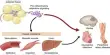 Obesity creates a complicated Inflammatory Response within Fat Tissue