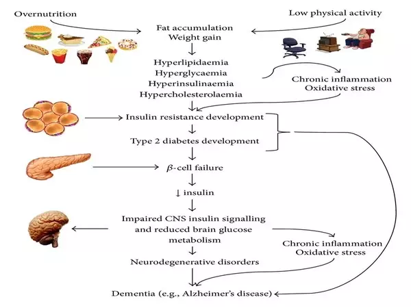 Obesity-has-been-related-to-Neurodegeneration-through-Insulin-Resistance-1