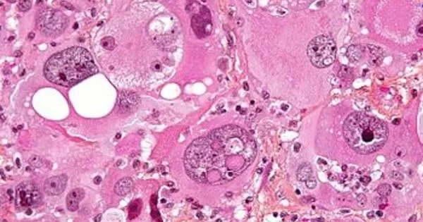 Pleomorphism – a term used in histology and cytopathology