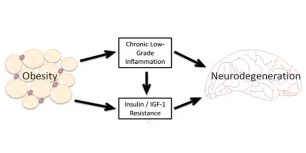 Obesity linked to neurodegeneration through insulin resistance