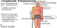 Thallium Poisoning
