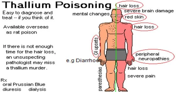 Thallium Poisoning