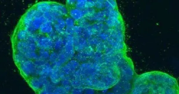Breast Cancer Cells are Energy-starved and Use their Surroundings as Fuel