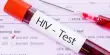 Researchers Identified the Most Probable cause of HIV Rebound Infection