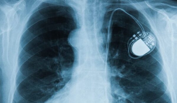 Scientists invent ultra-thin, minimally-invasive pacemaker controlled by light