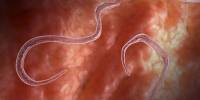 Temperature and Humidity may drive the Future Propagation of Parasitic Worm Infestations