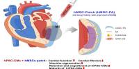 Advancing Cardiac Regeneration with Stem Cell-derived Heart Muscle Cells