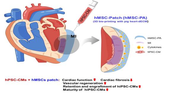 Advancing Cardiac Regeneration with Stem Cell-derived Heart Muscle Cells