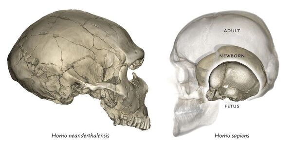 Genetic variant identified that shaped the human skull base