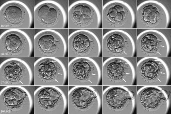 Unveiling the mysteries of cell division in embryos with timelapse photography