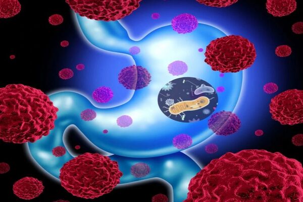 Vitamin D alters mouse gut bacteria to give better cancer immunity