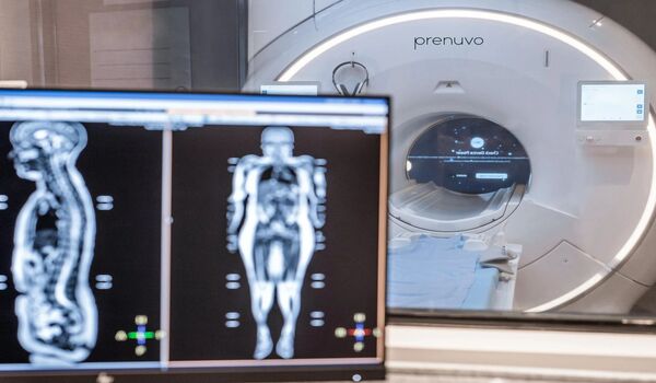New sensor detects errors in MRI scans