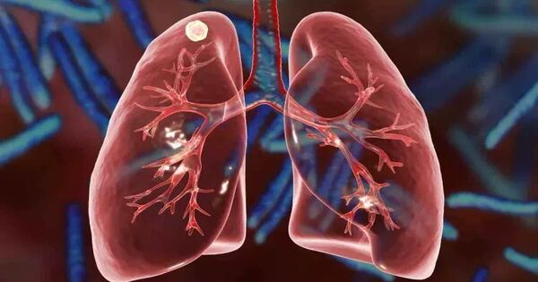 New Ultrasound Technology may Revolutionize the Diagnosis of Respiratory Diseases