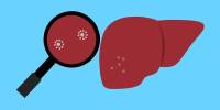Using a Magnetic Field to Guide Microrobots in Treating Liver Cancer