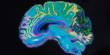 Abnormal Brain Anatomy found in Children with Developmental Language Issues