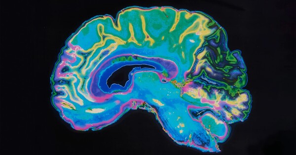 Abnormal Brain Anatomy found in Children with Developmental Language Issues