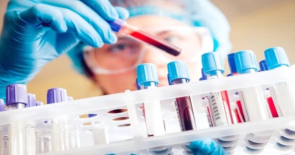 Blood Tests may Help Guide the use of Multiple Myeloma Immunotherapy