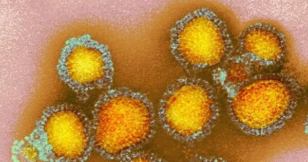 Influenza Viruses can employ two Methods to Infect Cells