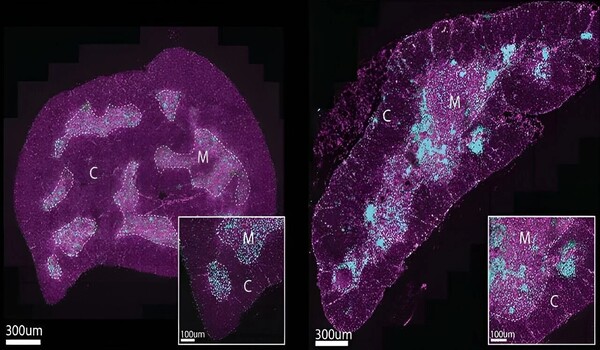 New clue into the curious case of our aging immune system