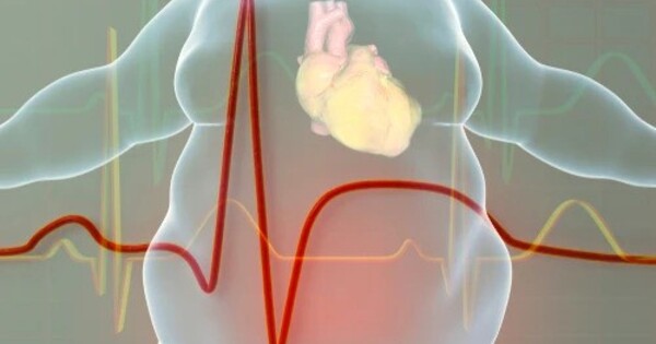 Obesity and Heart Failure are Linked