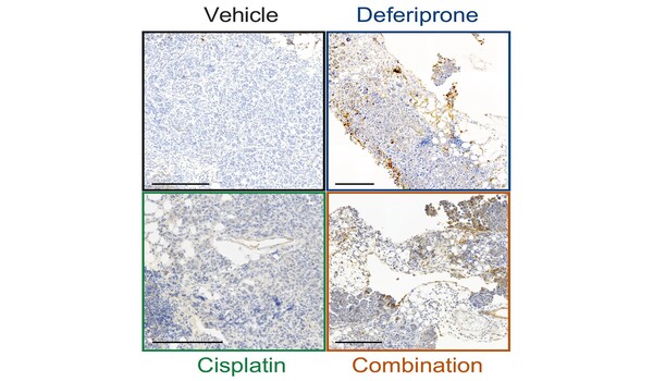 Preclinical study explores approved drug for ovarian cancer