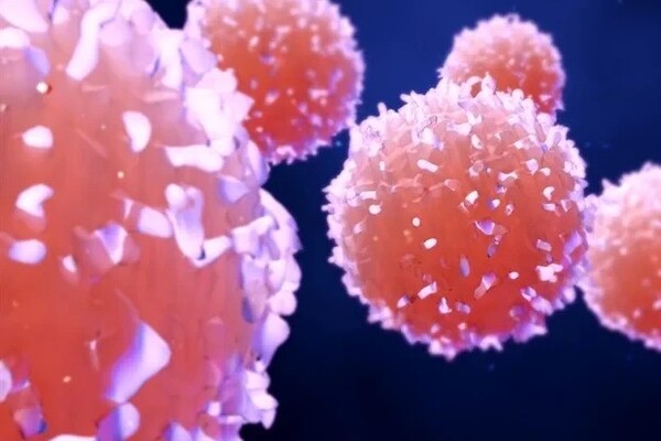 Tumor-infiltrating lymphocyte therapy marks a milestone in cancer treatment