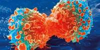 Tumor-infiltrating Lymphocyte Therapy represents a breakthrough in Cancer Treatment