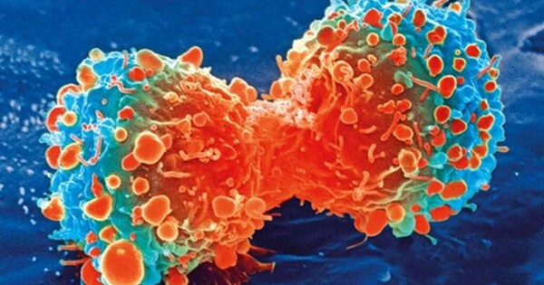 Tumor-infiltrating Lymphocyte Therapy represents a breakthrough in Cancer Treatment