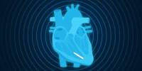 A Study reveals that Wireless Pacemakers provide Long-lasting, Dependable Performance