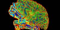 How does the Brain alter during Pregnancy?