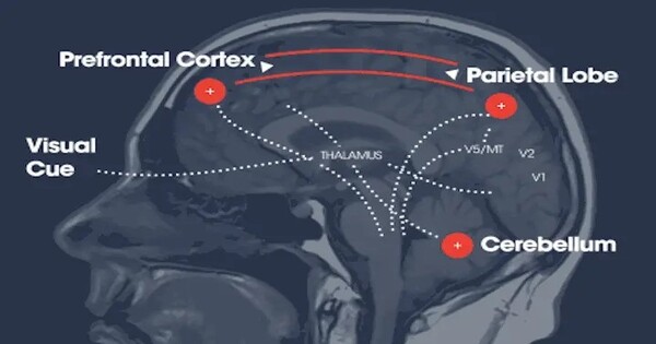 Improving Eye Tracking for Evaluating Brain Abnormalities