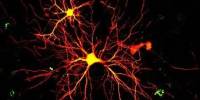 Neurons in Children with Autism seem different, according to studies