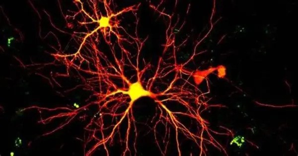 Neurons in Children with Autism seem different, according to studies