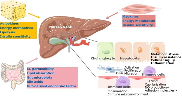 A New Technique to Treating Fatty Liver Disease