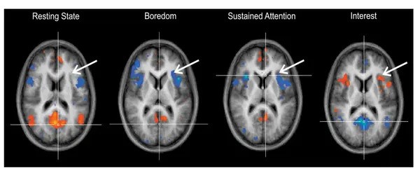 New method for quantifying boredom in the body during temporary stress