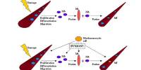 Advancement in Skeletal Muscle Regeneration