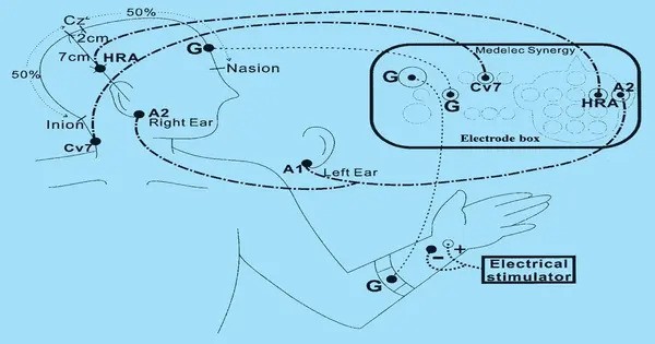 Somatosensory Electrical Stimulation’s impact on Hand Selection