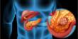 Biologists find targets for novel therapy for Pancreatic Cancer