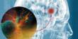 Scientists are baffled by Brain Cancer that consumes the Skull