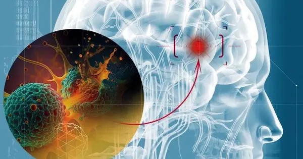 Scientists are baffled by Brain Cancer that consumes the Skull