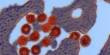 Modern Illnesses may be defeated by ancient Viruses concealed within Bacteria