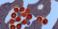 Modern Illnesses may be defeated by ancient Viruses concealed within Bacteria
