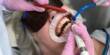 A New Method to Prevent Gum Disease without eliminating beneficial Bacteria