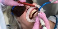 A New Method to Prevent Gum Disease without eliminating beneficial Bacteria