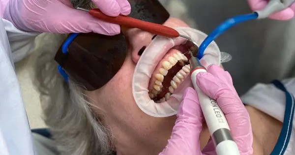 A New Method to Prevent Gum Disease without eliminating beneficial Bacteria